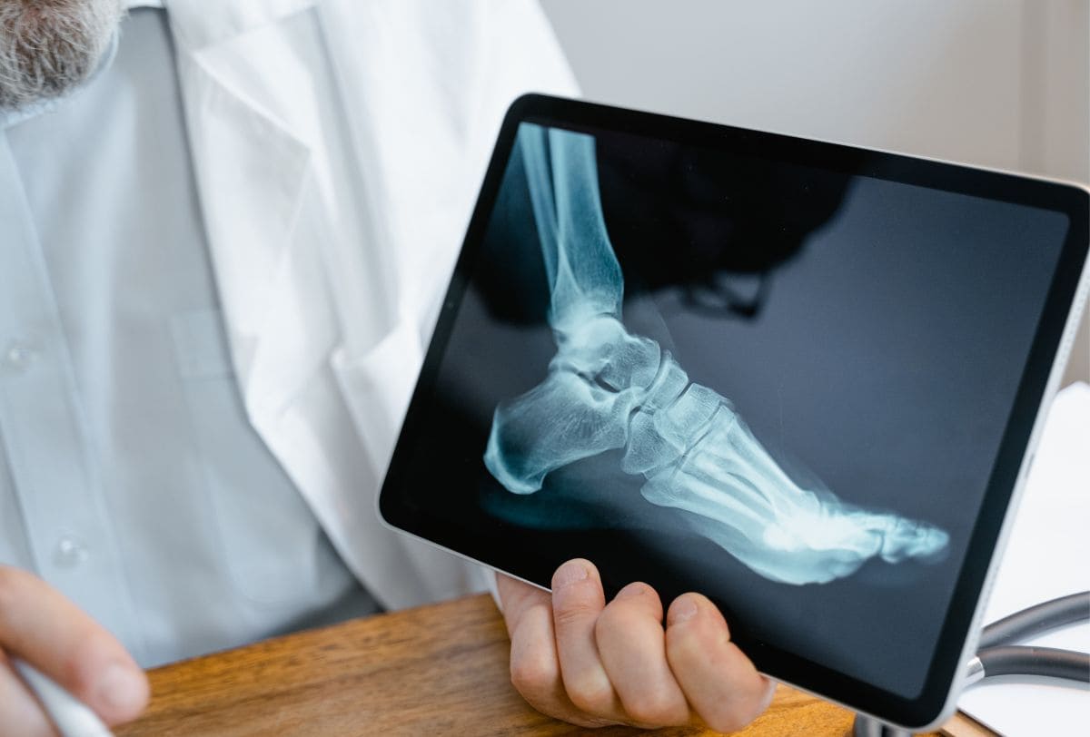 Precio consulta de Traumatólogo y Ortopedista en San Pedro Garza García Monterrey Nuevo León