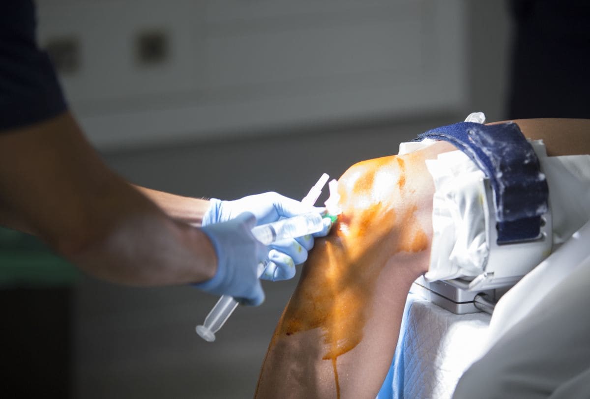 Qué hace un Traumatólogo y Ortopedista en San Pedro Garza García Monterrey Nuevo León